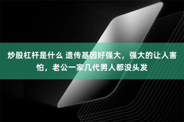 炒股杠杆是什么 遗传基因好强大，强大的让人害怕，老公一家几代男人都没头发